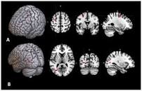 Brain Fleck Solution